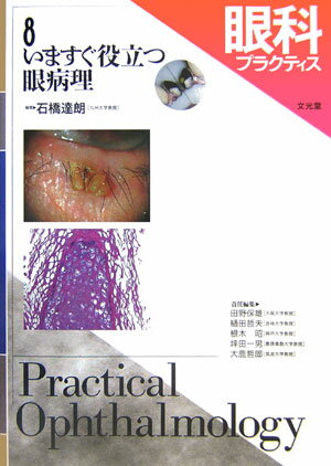 眼科プラクティス（8）
