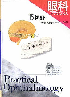 眼科プラクティス（15）