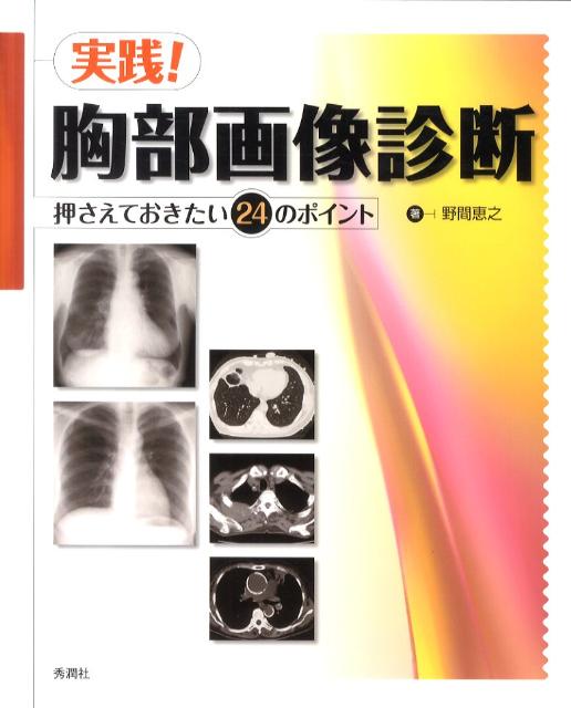 実践！胸部画像診断