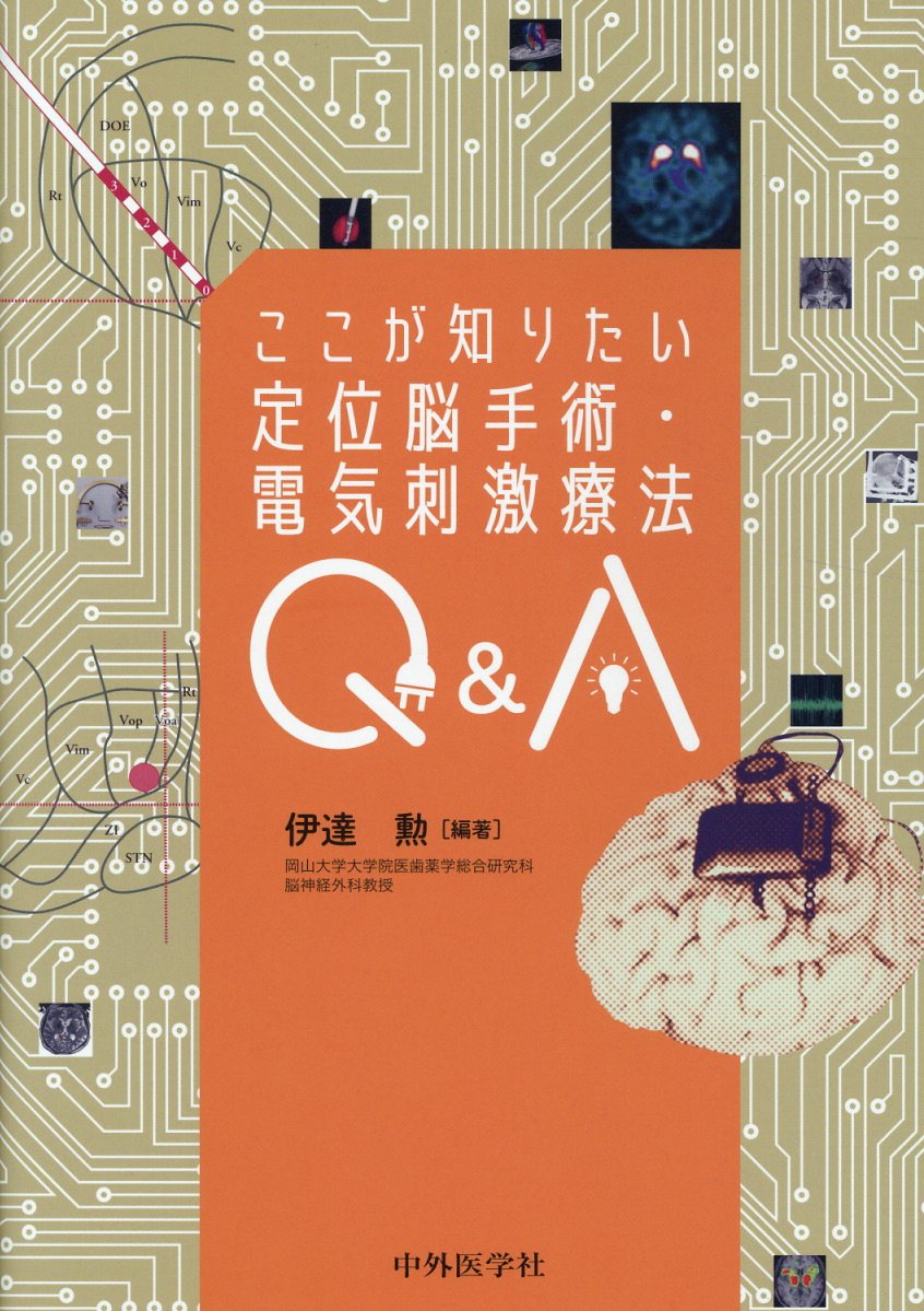 ここが知りたい定位脳手術・電気刺激療法Q＆A