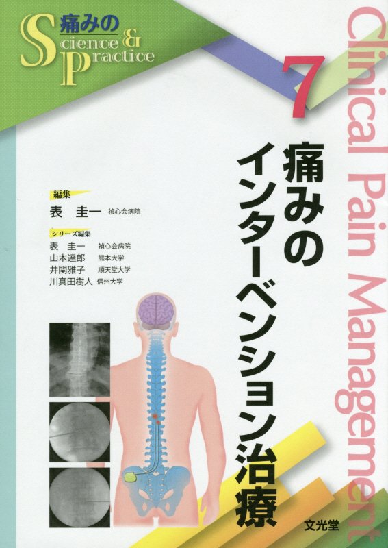 痛みのインターベンション治療