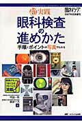 眼科検査の進めかた