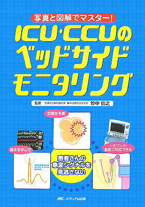 ICU��CCU�Υ٥åɥ����ɥ�˥����