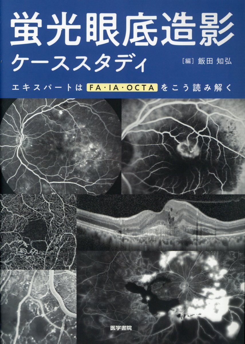 楽天楽天ブックス蛍光眼底造影ケーススタディ エキスパートはFA・IA・OCTAをこう読み解く [ 飯田 知弘 ]