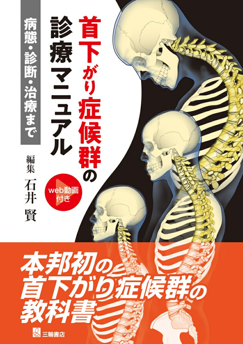 首下がり症候群診療マニュアルー病態・診断・治療まで