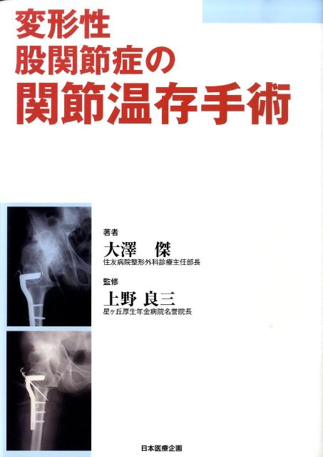 変形性股関節症の関節温存手術