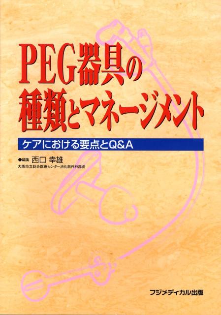 PEG器具の種類とマネージメント