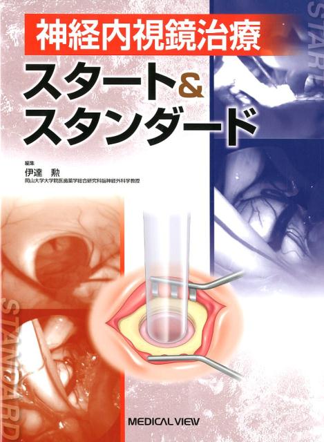 神経内視鏡治療スタート&スタンダード