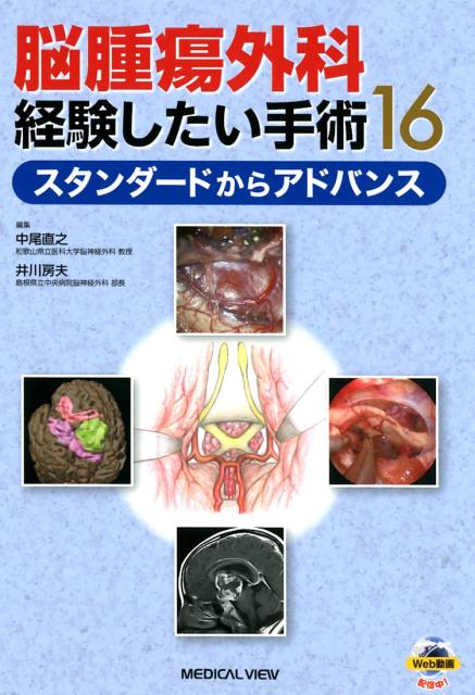 脳腫瘍外科経験したい手術16 スタンダードからアドバンス [ 中尾直之 ]