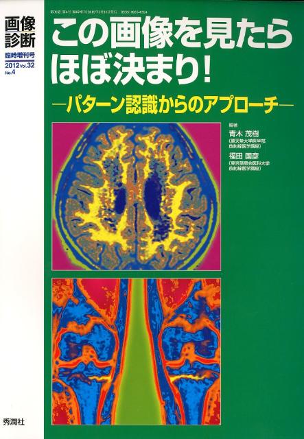 画像診断　2012年臨時増刊号32-4　この画像を見たら