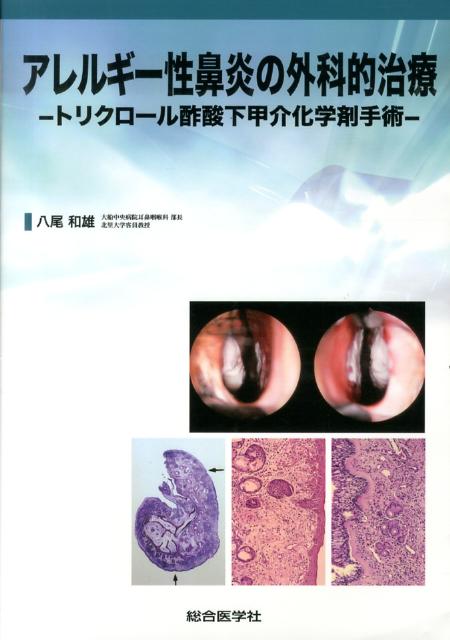 アレルギー性鼻炎の外科的治療 トリクロール酢酸下甲介化学剤手術 [ 八尾和雄 ]