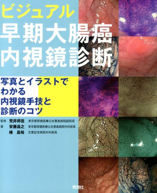 豊富な写真、イラストで早期大腸癌を見て理解できる早期大腸癌の診断のポイントを懇切・丁寧に解説。ビジュアルで内視鏡写真に慣れ親しめる構成！