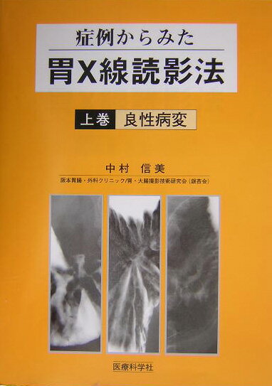 症例からみた胃X線読影法（上巻） 良性病変 [ 中村信美 ]