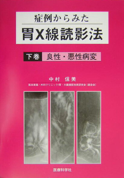 症例からみた胃X線読影法(下巻)