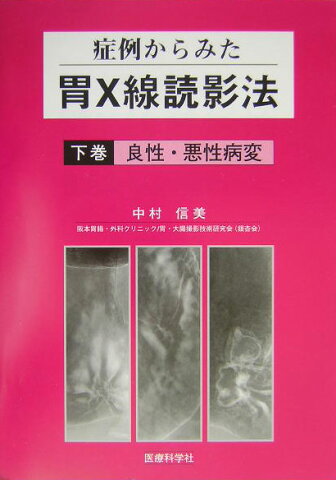 症例からみた胃X線読影法（下巻） 良性・悪性病変 [ 中村信美 ]