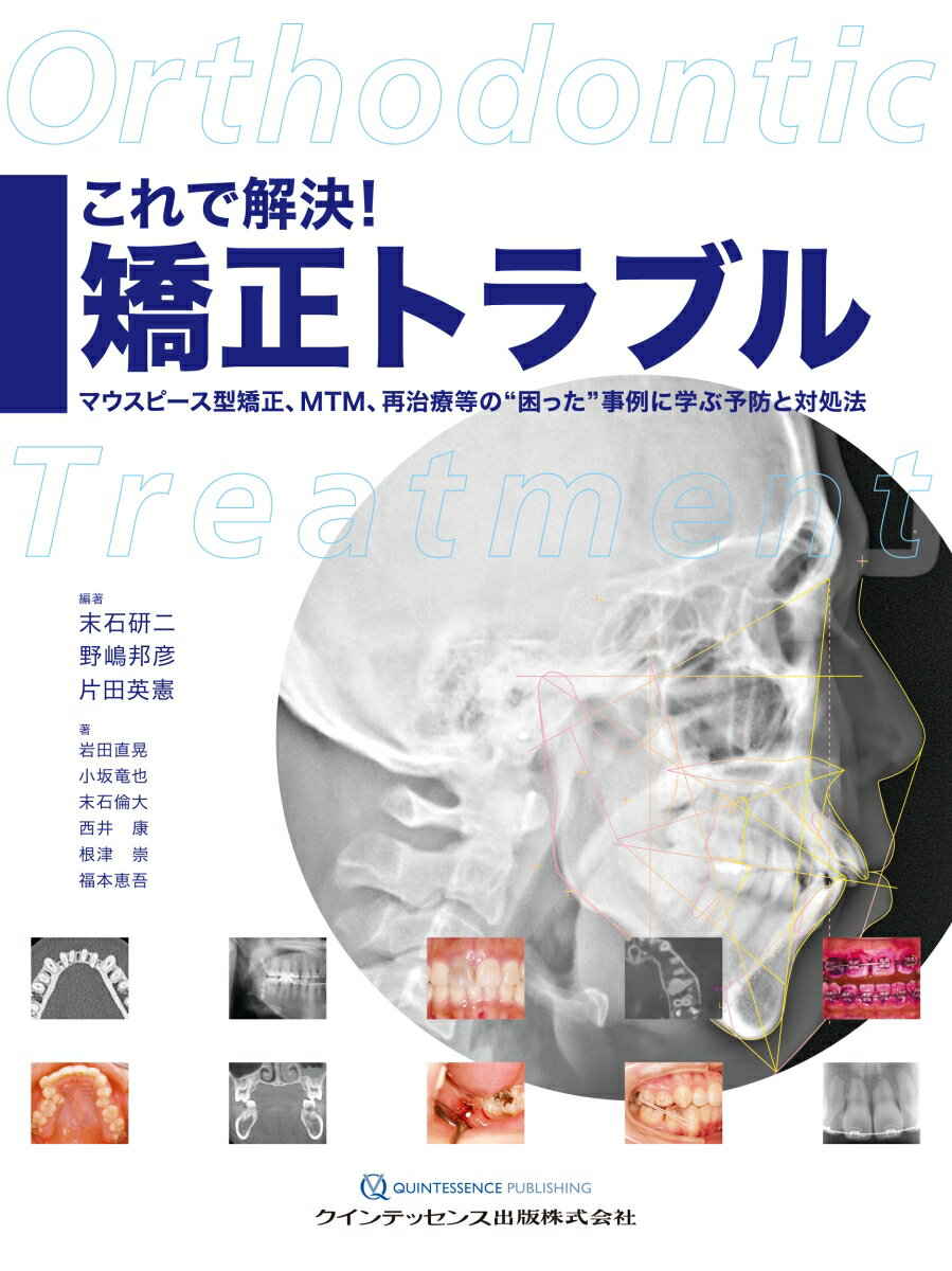 これで解決! 矯正トラブル マウスピース型矯正、MTM、再治療等の“困った”事例に学ぶ予防と対処法 [ 末石研二 ]