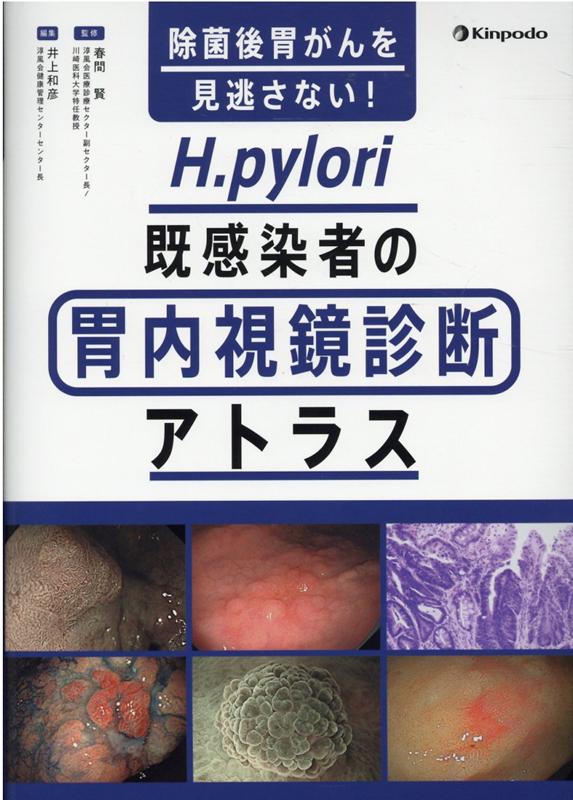 除菌後胃がんを見逃さない H．pylori既感染者の胃内視鏡診断アトラス [ 春間賢 ]