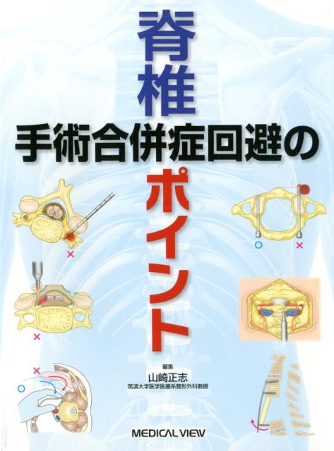 脊椎手術合併症回避のポイント [ 山崎正志 ]