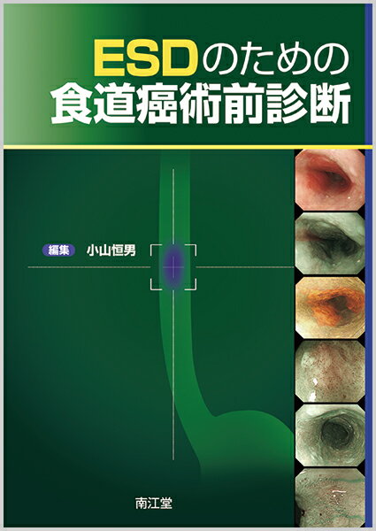 ESDのための食道癌術前診断 [ 小山　恒男 ]