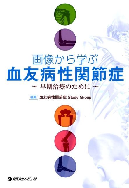 画像から学ぶ血友病性関節症