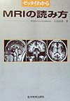 ゼッタイわかるMRIの読み方