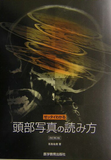 ゼッタイわかる頭部写真の読み方改訂第3版