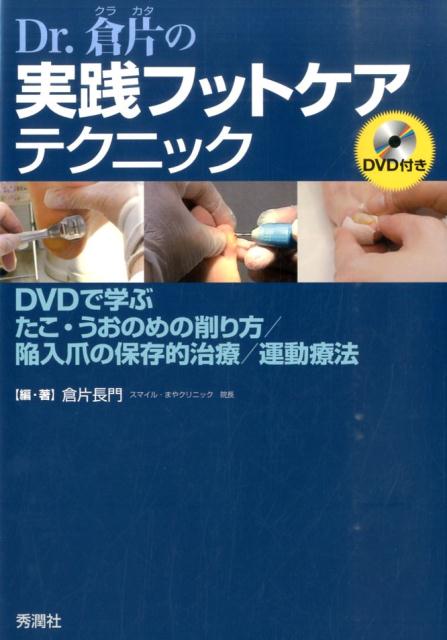 Dr．倉片の実践フットケアテクニック DVDで学ぶ　たこ・うおのめ削り方／陥入爪の保存的治療／運動療法 [ 倉片 長門 ]