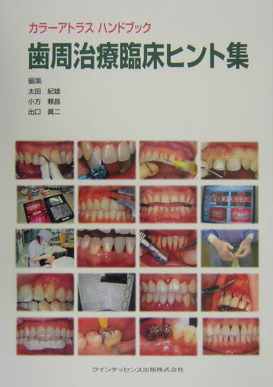 歯周治療臨床ヒント集