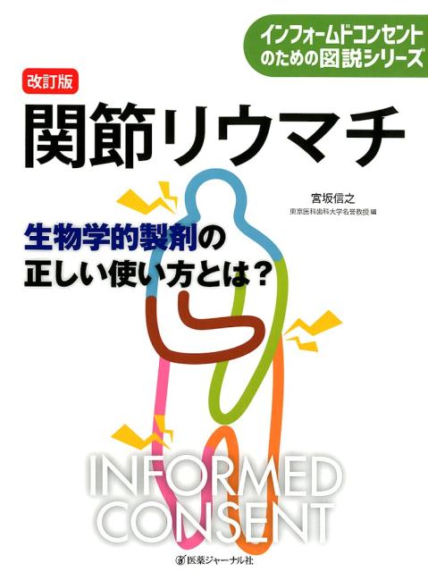 関節リウマチ　改訂版