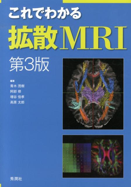 これでわかる拡散MRI　第3版 [ 青木茂樹 ]