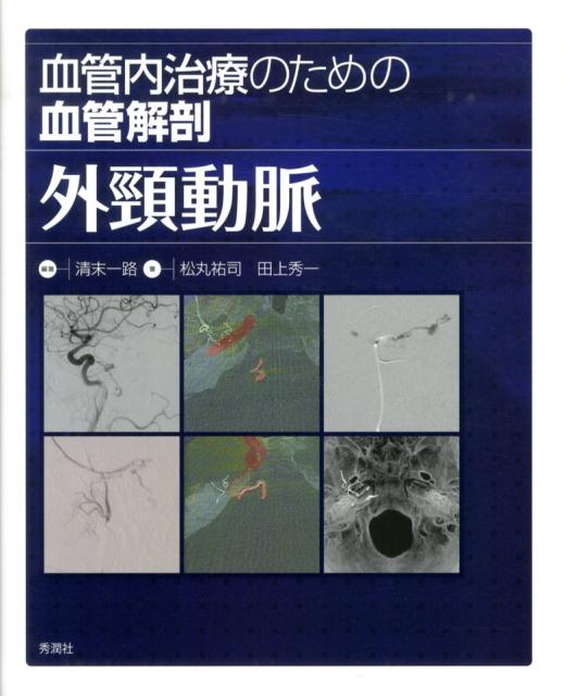 血管内治療のための血管解剖　外頸動脈 [ 清末一路 ]