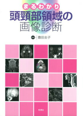 たくさんの症例と画像が疾患毎にコンパクトにまとまっているので、どこからでも読み始められます。病理、解剖、発生、ＣＴ・ＭＲＩの新技術、血管造影、動注など総論も掲載。各章にある「解剖」「鑑別診断と画像診断の進め方」も必読です！