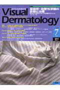 ヴィジュアル・ダーマトロジー　05年7月号（4-7）