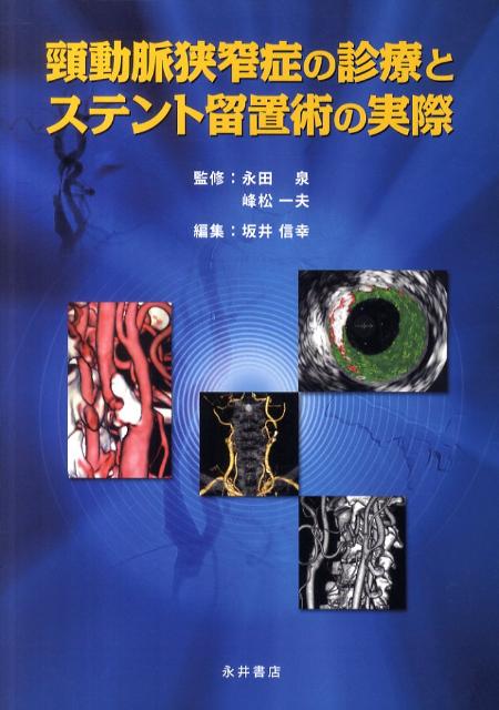 頚動脈狭窄症の診療とステント留置術の実際