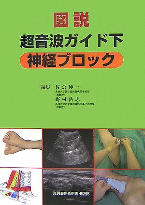 図説超音波ガイド下神経ブロック