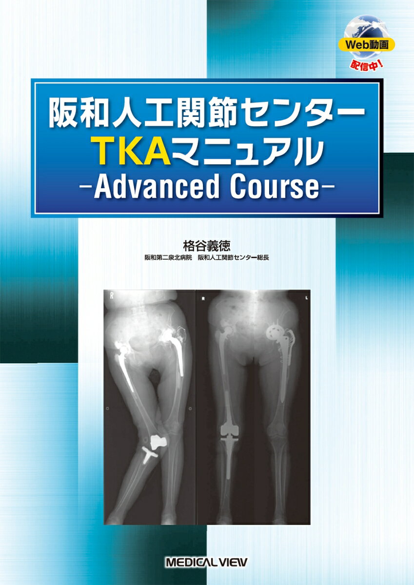 阪和人工関節センター TKAマニュアル　Advanced Course