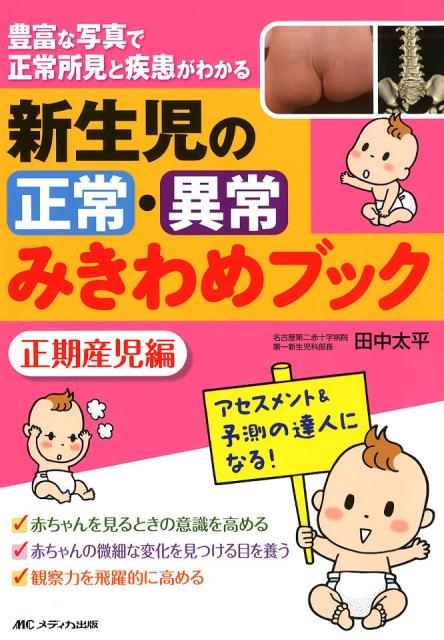 新生児の正常・異常みきわめブック　正期産児編