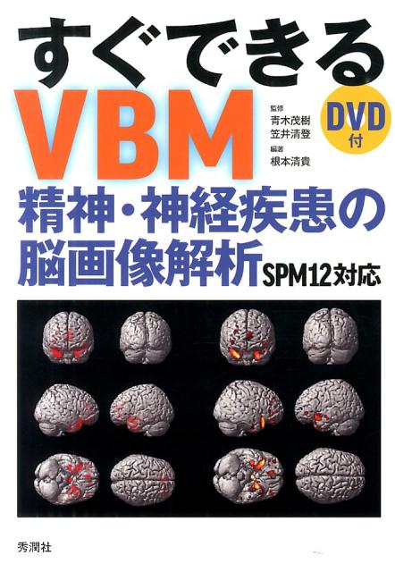 すぐできるVBM 精神・神経疾患の脳画像解析　SPM12対応　DVD付 [ 青木茂樹 ]