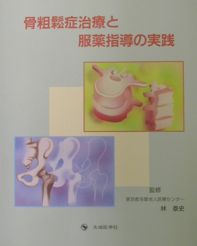 骨粗鬆症治療と服薬指導の実践
