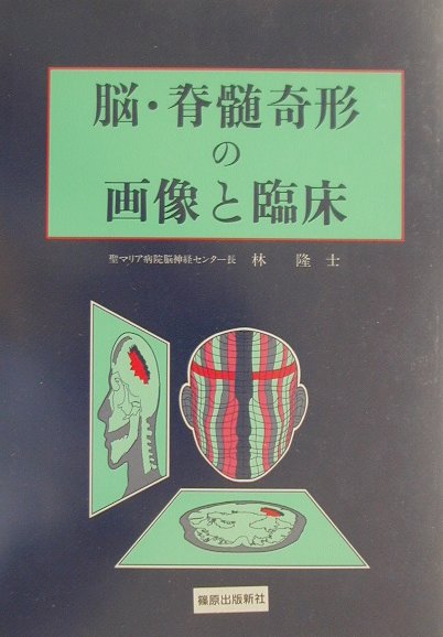 脳・脊髄奇形の画像と臨床