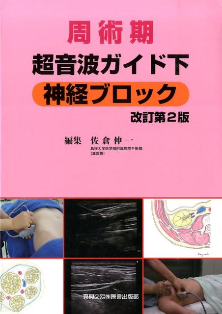 周術期超音波ガイド下神経ブロック　改訂第2版