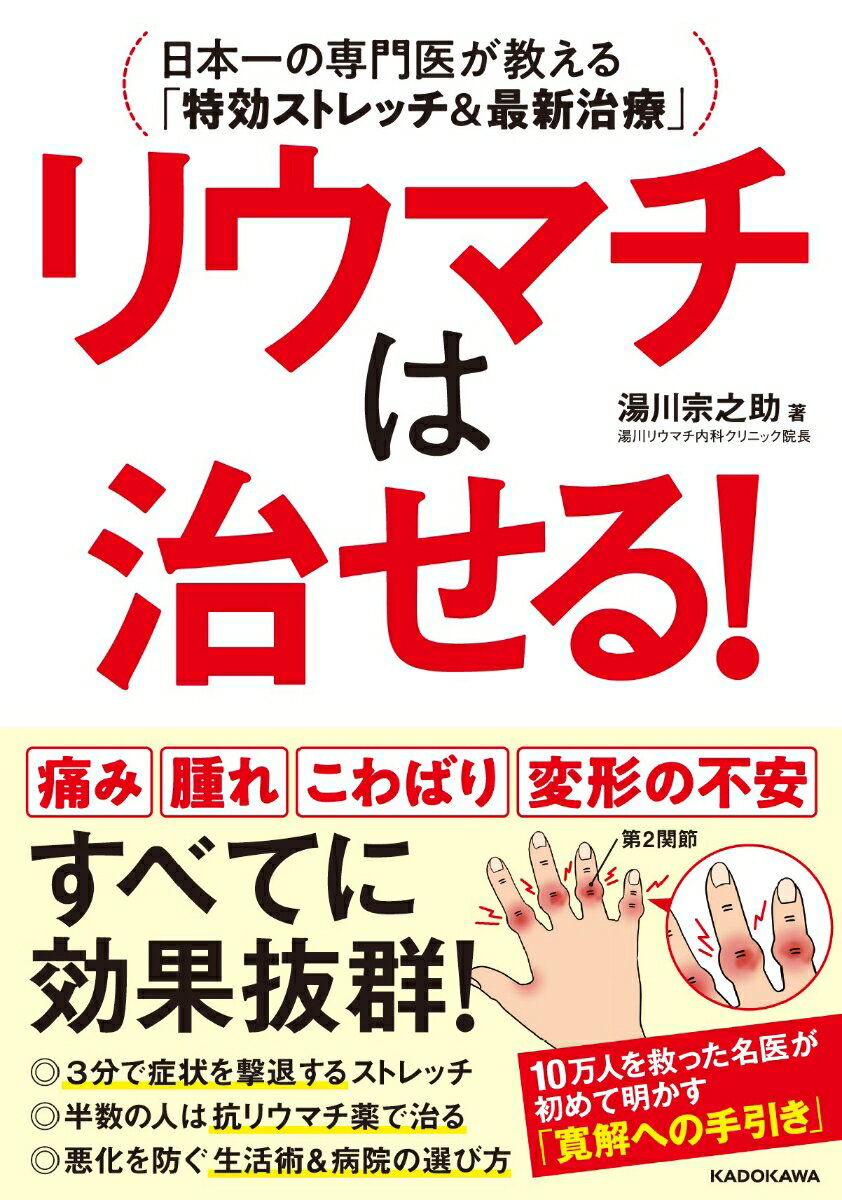 湯川　宗之助 KADOKAWAリウマチハナオセル ニホンイチノセンモンイガオシエルトッコウストレッチアンドサイシンチリョウ ユカワ　ソウノスケ 発行年月：2020年10月22日 予約締切日：2020年09月16日 ページ数：176p サイズ：単行本 ISBN：9784046048844 湯川宗之助（ユカワソウノスケ） 湯川リウマチ内科クリニック院長。父、兄ともにリウマチの専門医というリウマチ医一家に生まれる。2000年、東京医科大学医学部医学科卒業。研修医時代、20代の女性がリウマチで手が変形した姿を見たのがきっかけで、当時は難病と考えられていたリウマチ・膠原病の専門医を志す。東京医科大学病院第三内科（リウマチ・膠原病科）、産業医科大学医学部第一内科学講座を経て、2015年に湯川リウマチ内科クリニック院長就任。親子2代で50年以上にわたりリウマチの研究を続け、患者数や症例数は日本一を誇る。日本リウマチ学会専門医・評議員（本データはこの書籍が刊行された当時に掲載されていたものです） リウマチの「基本のキ」がわかるQ＆A／1　「リウマチは治らない」とあきらめていませんか？／2　5割の人は抗リウマチ薬で治る／3　1日3分！リウマチ撃退「ゆるストレッチ」／4　痛みを悪化させない！12の生活習慣／5　リウマチを治す主人公は「あなた自身」 痛み、腫れ、こわばり、変形の不安、すべてに効果抜群！3分で症状を撃退するストレッチ。半数の人は抗リウマチ薬で治る。悪化を防ぐ生活術＆病院の選び方。10万人を救った名医が初めて明かす「寛解への手引き」。 本 美容・暮らし・健康・料理 健康 家庭の医学