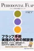 Periodontal　flap