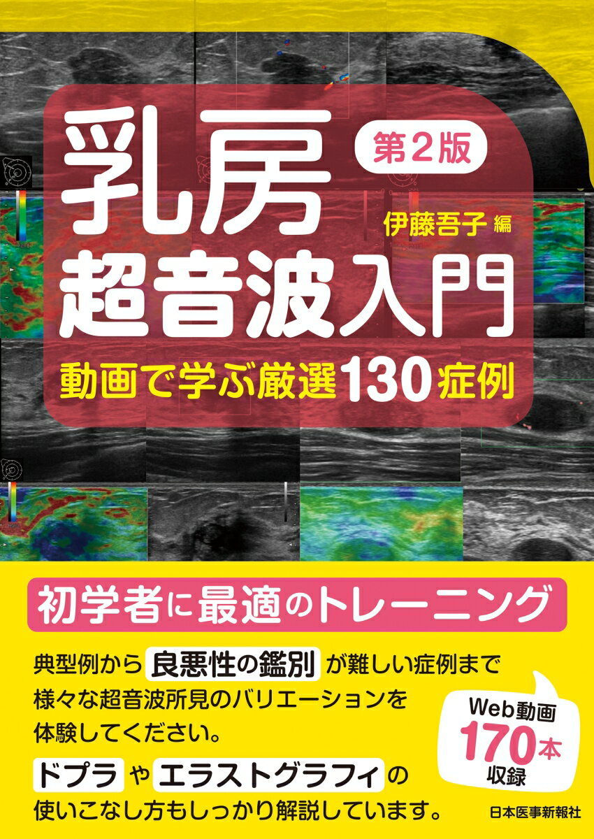 乳房超音波入門