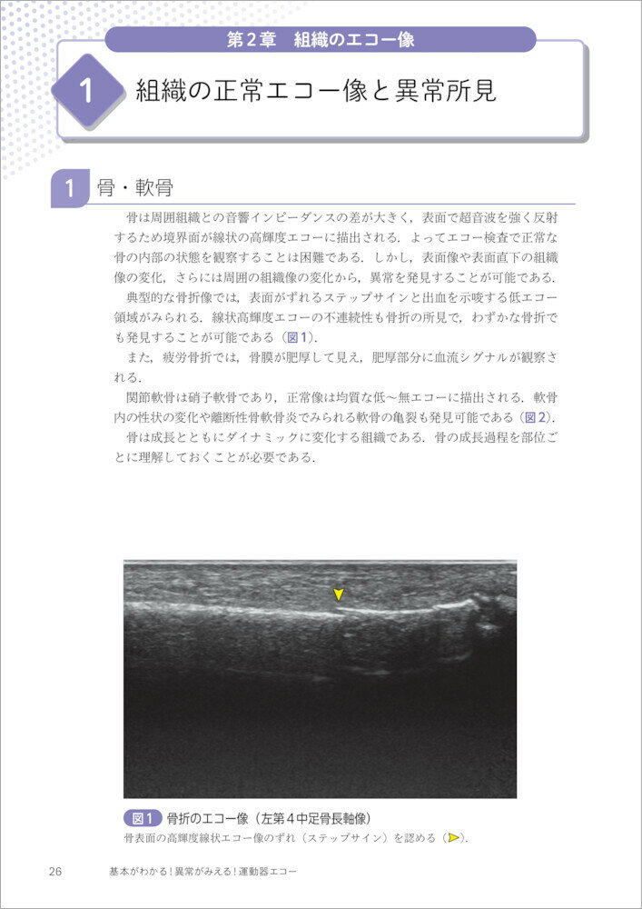 基本がわかる!異常がみえる!運動器エコー [ ...の紹介画像3