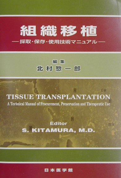 組織移植