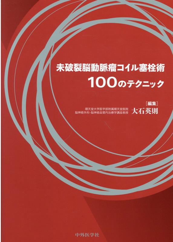 未破裂脳動脈瘤コイル塞栓術100のテクニック [ 大石英則 ]