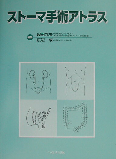 ストーマ手術アトラス