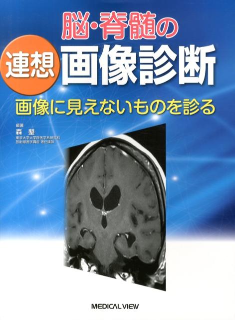 脳・脊髄の連想画像診断