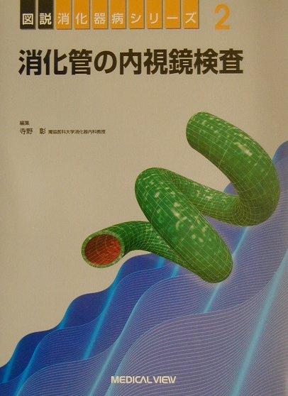 消化管の内視鏡検査